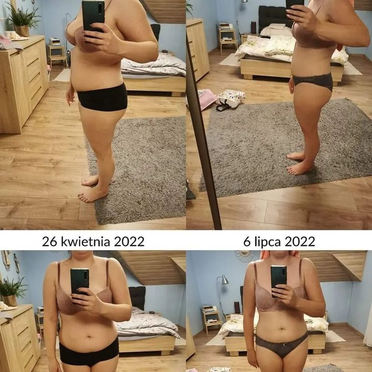 Klientka przed i po: 26 kwietnia i 6 lipca 2022, z boku i z przodu